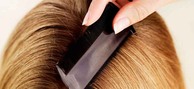 Remedios naturales eficaces para luchar contra los piojos Remedios naturales eficaces para luchar contra los piojos
