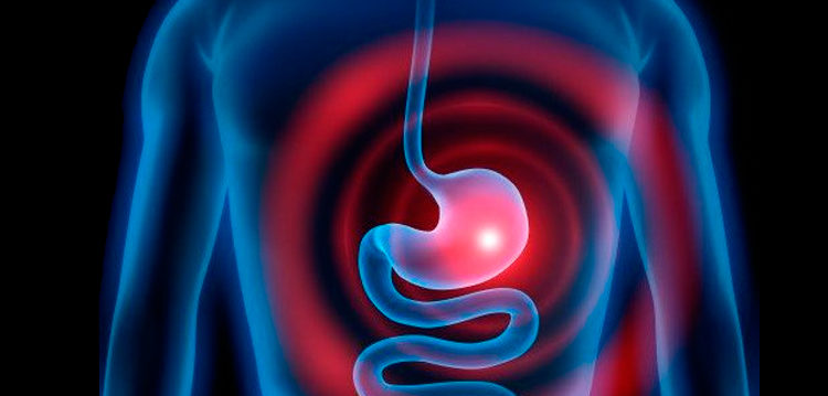 La Gastritis y Tratamientos Naturales